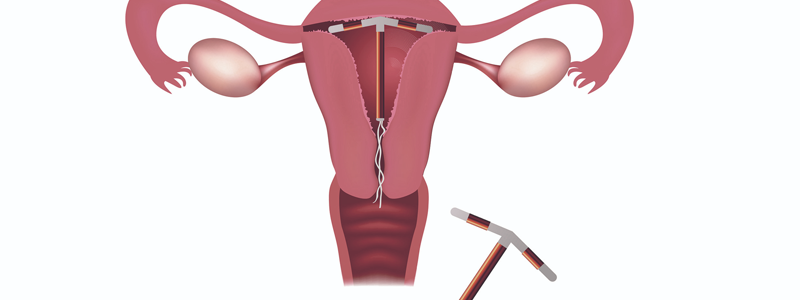 Gynecologist & IVF Specialist